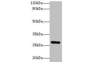 Western blot All lanes: Fgf23 antibody at 2 μg/mL + Rat heart tissue Secondary Goat polyclonal to rabbit IgG at 1/10000 dilution Predicted band size: 28 kDa Observed band size: 28 kDa (FGF23 抗体  (AA 25-251))