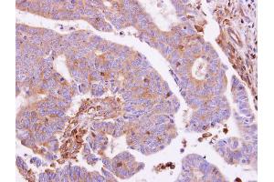 Immunohistochemistry (IHC) image for anti-Guanine Nucleotide Binding Protein (G Protein), alpha Inhibiting Activity Polypeptide 1 (GNAI1) (Center) antibody (ABIN2856077)