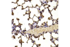 Immunohistochemistry of paraffin-embedded mouse lung using WHSC1 antibody (ABIN6128925, ABIN6150213, ABIN6150214 and ABIN6223939) at dilution of 1:100 (40x lens). (WHSC1 抗体  (AA 1-240))