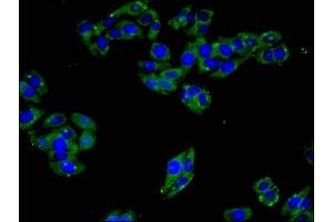 Immunofluorescent analysis of HepG2 cells using ABIN7151350 at dilution of 1:100 and Alexa Fluor 488-congugated AffiniPure Goat Anti-Rabbit IgG(H+L) (ART3 抗体  (AA 279-352))