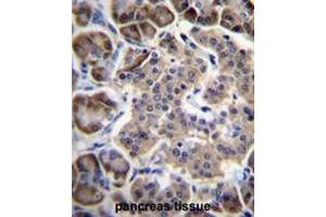 RPL15 Antibody (N-term) immunohistochemistry analysis in formalin fixed and paraffin embedded human pancreas tissue followed by peroxidase conjugation of the secondary antibody and DAB staining. (RPL15 抗体  (N-Term))