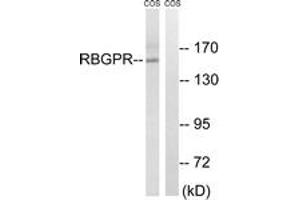 Western blot analysis of extracts from COS cells, using RAB3GAP2 Antibody. (RAB3GAP2 抗体  (AA 417-466))