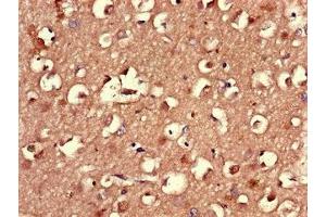 Immunohistochemistry of paraffin-embedded human brain tissue using ABIN7164558 at dilution of 1:100 (LMBRD1 抗体  (AA 6-100))