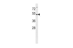 Western blot analysis in Ramos cell line lysates (35ug/lane). (MAT2A 抗体  (N-Term))