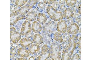 Immunohistochemistry of paraffin-embedded Mouse kidney using AP2A1 Polyclonal Antibody at dilution of 1:100 (40x lens). (alpha Adaptin 抗体)