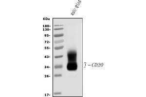 Western blot analysis of CD20/MS4A1 using anti-CD20/MS4A1 antibody (ABIN7599223).