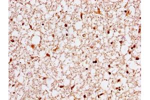 IHC image of ABIN7142091 diluted at 1:400 and staining in paraffin-embedded human brain tissue performed on a Leica BondTM system. (14-3-3 eta 抗体  (AA 4-246))