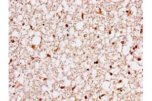IHC image of ABIN7142091 diluted at 1:400 and staining in paraffin-embedded human brain tissue performed on a Leica BondTM system.