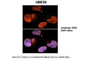 Sample Type :  Human brain stem cells  Primary Antibody Dilution :  1:500  Secondary Antibody :  Goat anti-rabbit Alexa-Fluor 594  Secondary Antibody Dilution :  1:1000  Color/Signal Descriptions :  UBE2N: Red DAPI:Blue  Gene Name :  UBE2N  Submitted by :  Dr. (UBE2N 抗体  (Middle Region))