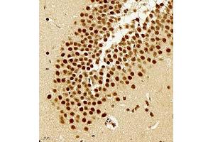 Immunohistochemistry (Paraffin-embedded Sections) (IHC (p)) image for anti-Telomeric Repeat Binding Factor 2, Interacting Protein (TERF2IP) antibody (ABIN7075857)