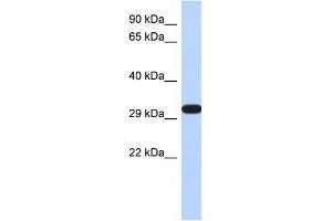 DDAH2 antibody used at 1 ug/ml to detect target protein. (DDAH2 抗体  (N-Term))
