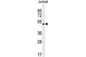 SNIP1 Antibody (N-term) western blot analysis in Jurkat cell line lysates (35µg/lane). (SNIP1 抗体  (N-Term))