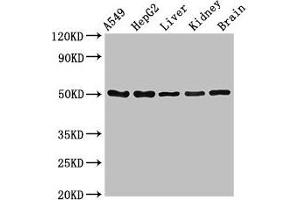Western Blot Positive WB detected in: A549 whole cell lysate, HepG2 whole cell lysate, Mouse liver tissue, Mouse kidney tissue, Mouse brain tissue All lanes: SLC33A1 antibody at 2. (SLC33A1 抗体  (AA 1-74))