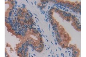 Immunohistochemistry (IHC) image for anti-Breast Cancer 1 (BRCA1) (AA 19-83) antibody (ABIN7433579)