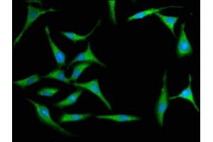 Immunofluorescence staining of Hela cells with ABIN6999591 at 1:100, counter-stained with DAPI. (MX2 抗体  (AA 548-688))