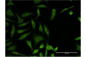 Immunofluorescence of monoclonal antibody to OXSR1 on HeLa cell. (OXSR1 抗体  (AA 351-450))