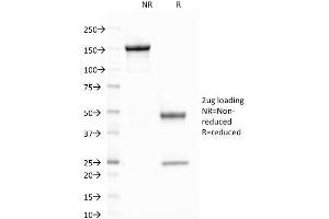 SDS-PAGE Analysis Purified CELA3B Mouse Monoclonal Antibody (CELA3B/1758). (Elastase 3B 抗体  (AA 82-238))