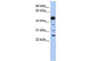 PGDS antibody used at 1 ug/ml to detect target protein. (PTGDS 抗体  (N-Term))