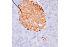 Immunohistochemistry of paraffin-embedded mouse pancreas using Phospho-ACLY-S455 antibody (ABIN6135178, ABIN6136002, ABIN6136003 and ABIN6225678) at dilution of 1:100 (40x lens). (ACLY 抗体  (pSer455))
