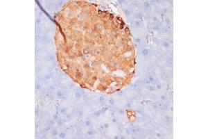 Immunohistochemistry of paraffin-embedded mouse pancreas using Phospho-ACLY-S455 antibody (ABIN6135178, ABIN6136002, ABIN6136003 and ABIN6225678) at dilution of 1:100 (40x lens). (ACLY 抗体  (pSer455))