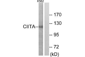 Western blot analysis of extracts from K562 cells, using CIITA antibody. (CIITA 抗体  (Internal Region))