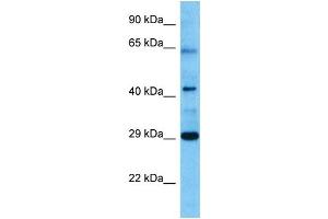Host:  Mouse  Target Name:  VDR  Sample Tissue:  Mouse Pancreas  Antibody Dilution:  1ug/ml (Vitamin D Receptor 抗体  (N-Term))