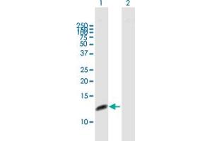 Western Blot analysis of RPA3 expression in transfected 293T cell line by RPA3 MaxPab polyclonal antibody. (RPA3 抗体  (AA 1-121))