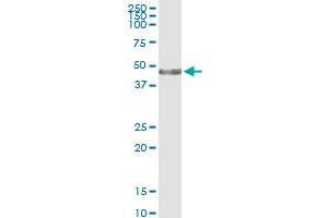 Immunoprecipitation of KRT34 transfected lysate using anti-KRT34 MaxPab rabbit polyclonal antibody and Protein A Magnetic Bead , and immunoblotted with KRTHA4 MaxPab mouse polyclonal antibody (B01) . (Keratin 34 抗体  (AA 1-436))