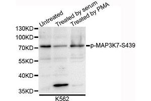 Western blot analysis of extracts of K562 cells, using Phospho-MAP3K7-S439 antibody. (MAP3K7 抗体  (pSer412))