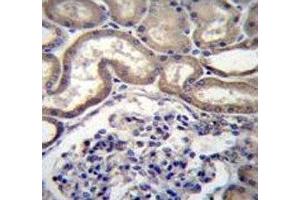 STIM2 antibody immunohistochemistry analysis in formalin fixed and paraffin embedded human kidney tissue. (Stim2 抗体  (AA 98-127))