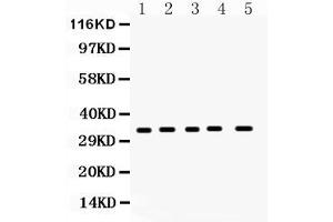 Western blot analysis of CCS expression in rat brain extract ( Lane 1), rat spleen extract ( Lane 2), mouse brain extract ( Lane 3), mouse spleen extract ( Lane 4) and 293T whole cell lysates ( Lane 5). (Superoxide dismutase copper chaperone 抗体  (C-Term))