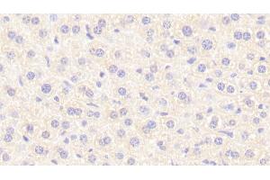 Detection of NT in Mouse Liver Tissue using Polyclonal Antibody to Neurotensin (NT) (Neurotensin 抗体  (AA 42-167))