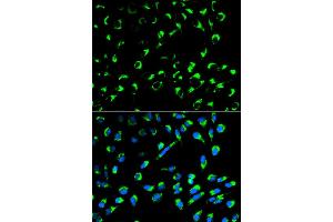 Immunofluorescence analysis of MCF-7 cells using SFN antibody. (14-3-3 sigma/SFN 抗体)