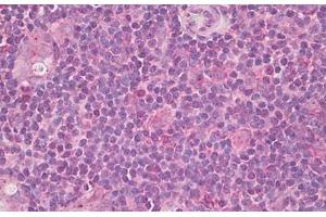 Image no. 1 for anti-Inducible T-Cell Co-Stimulator Ligand (ICOSLG) (AA 197-246) antibody (ABIN6749802) (ICOSLG 抗体  (AA 197-246))