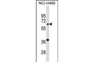 Western blot analysis in NCI-H460 cell line lysates (35ug/lane). (PET112L 抗体  (N-Term))