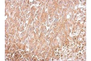 Immunohistochemistry (IHC) image for anti-Amphiphysin (AMPH) (N-Term) antibody (ABIN2855590)