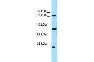 WB Suggested Anti-SLC13A1 Antibody Titration: 1. (SLC13A1 抗体  (N-Term))