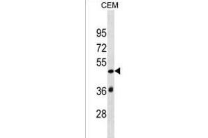 SP140L Antibody (Center) (ABIN1537899 and ABIN2849879) western blot analysis in CEM cell line lysates (35 μg/lane). (SP140L 抗体  (AA 158-185))