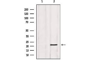 Western blot analysis of extracts from Hela, using PGRMC1 Antibody. (PGRMC1 抗体  (C-Term))