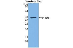 Western blot analysis of the recombinant protein. (Kallikrein 1 抗体  (AA 21-261))