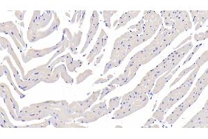 Detection of FUCa1 in Mouse Cardiac Muscle Tissue using Polyclonal Antibody to Fucosidase Alpha L1, Tissue (FUCa1) (FUCA1 抗体  (AA 185-447))
