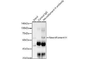 Immunoprecipitation analysis of 300 μg extracts of PC-3 cells using 3 μg Neurofilament H antibody (ABIN7268866). (NEFH 抗体)