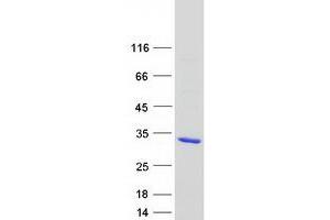 Western Blotting (WB) image for RAB39A, Member RAS Oncogene Family (RAB39A) protein (Myc-DYKDDDDK Tag) (ABIN2730346)