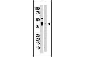 The anti-MBD2 N-term Antibody (ABIN387915 and ABIN2844333) is used in Western blot to detect MBD2 in  cell lysate (lane 1) and mouse brain tissue lysate (lane 2) lysate. (MBD2 抗体  (AA 120-151, AA 120-152))