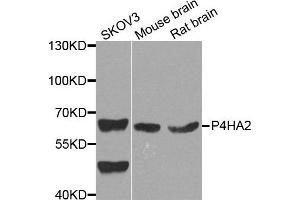 Western blot analysis of extract of various cells, using P4HA2 antibody. (P4HA2 抗体)