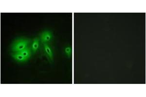 Immunofluorescence analysis of A549 cells, using ADCY8 Antibody. (ADCY8 抗体  (AA 591-640))