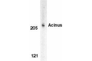 Western blot analysis of Acinus in K562 whole cell lysate with Acinus antibody at 1 μg/ml. (ACIN1 抗体)