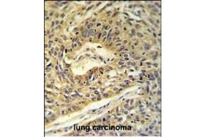 Immunohistochemistry (Paraffin-embedded Sections) (IHC (p)) image for anti-ATP Synthase, H+ Transporting, Mitochondrial F1 Complex, alpha Subunit 1, Cardiac Muscle (ATP5A1) (AA 477-503), (C-Term) antibody (ABIN653734)