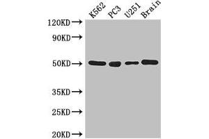 Western Blot Positive WB detected in: K562 whole cell lysate, PC-3 whole cell lysate, U251 whole cell lysate, Mouse brain tissue All lanes: TUBA1C antibody at 3 μg/mL Secondary Goat polyclonal to rabbit IgG at 1/50000 dilution Predicted band size: 50 kDa Observed band size: 50 kDa (TUBA1C 抗体  (AA 29-184))