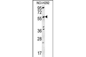 STA18 Antibody (N-term) (ABIN657881 and ABIN2846836) western blot analysis in NCI- cell line lysates (15 μg/lane). (SPATA18 抗体  (N-Term))